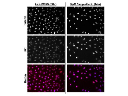 <b>Immunofluorescence of camptothecin-treated A549 cells.</b>  A549 cells were plated on 96-well plates and treated with 10µM camptothecin or 0.4% DMSO control for 24 hours prior to fixation.  Cell handling, fixation and immunostaining were performed using HCS234 kit reagents and protocols.  Cells were imaged on a GE IN Cell Analyzer 1000 (3.4) at 20X objective magnification.  Top and middle panels:  Monochromatic images of Hoechst HCS Nuclear Stain and p21 fluorescence.  Note the increase in p21 nuclear intensity following camptothecin treatment.  Bottom panel:  Fused images of Hoechst HCS Nuclear Stain (blue) and p21 fluorescence (red).  Note that auto-contrasting in fused images may result in haziness due to low intensity signal contribution.